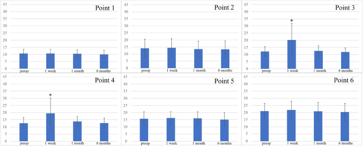 Quantitative Evaluation of Peripheral Nerve Injury in Endovenous Laser Ablation with or without Microphlebectomy: Prospective Cohort Study of 25 Cases.