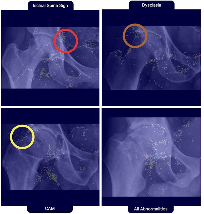 Characterizing hip joint morphology using a multitask deep learning model.