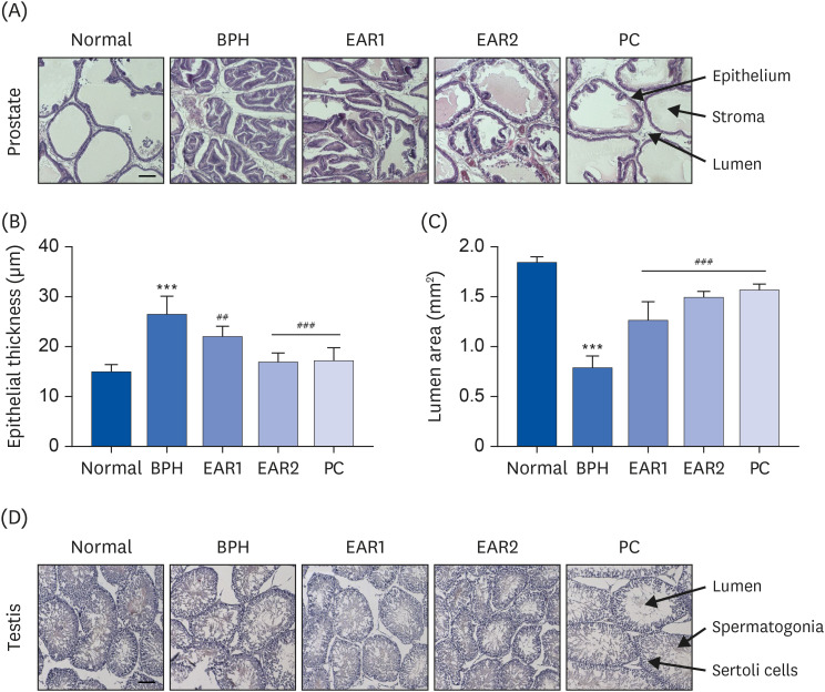 <i>Asparagi radix</i> alleviates testosterone-induced benign prostatic hyperplasia by inhibiting 5α-reductase activity and androgen receptor signaling pathway.