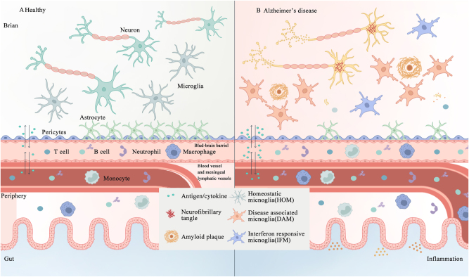 Immune cells in Alzheimer's disease: insights into pathogenesis and potential therapeutic targets.