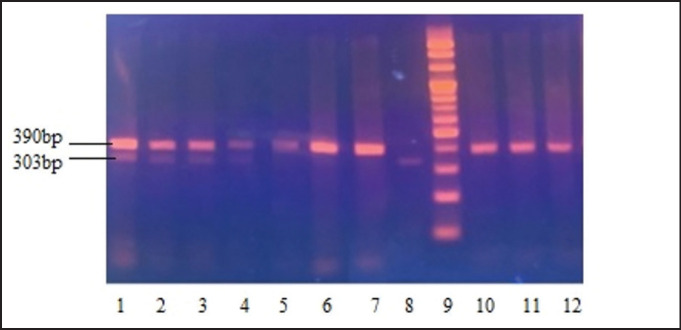 Genetic characterization of LEP and TG5 gene polymorphisms in crossbred beef cattle populations.