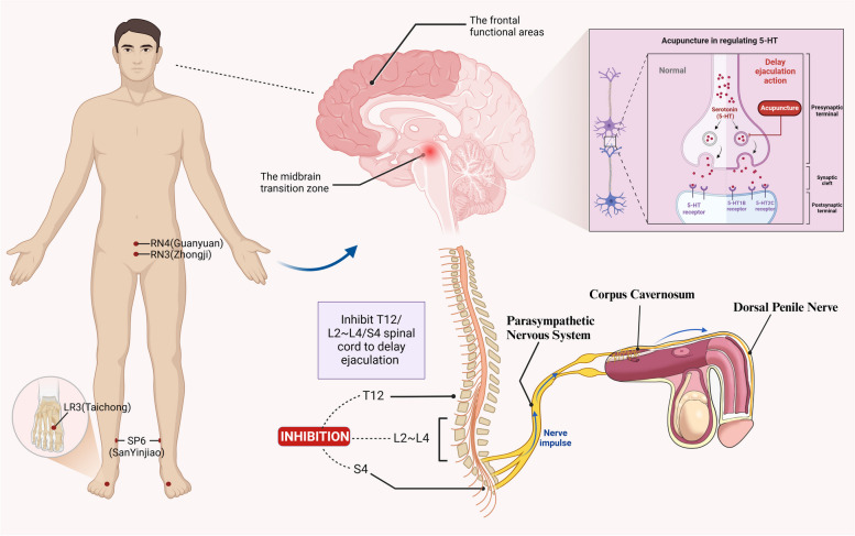 The role of acupuncture in treating premature ejaculation and its probable neurobiological mechanism.