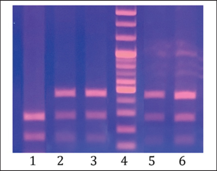 Genetic characterization of LEP and TG5 gene polymorphisms in crossbred beef cattle populations.
