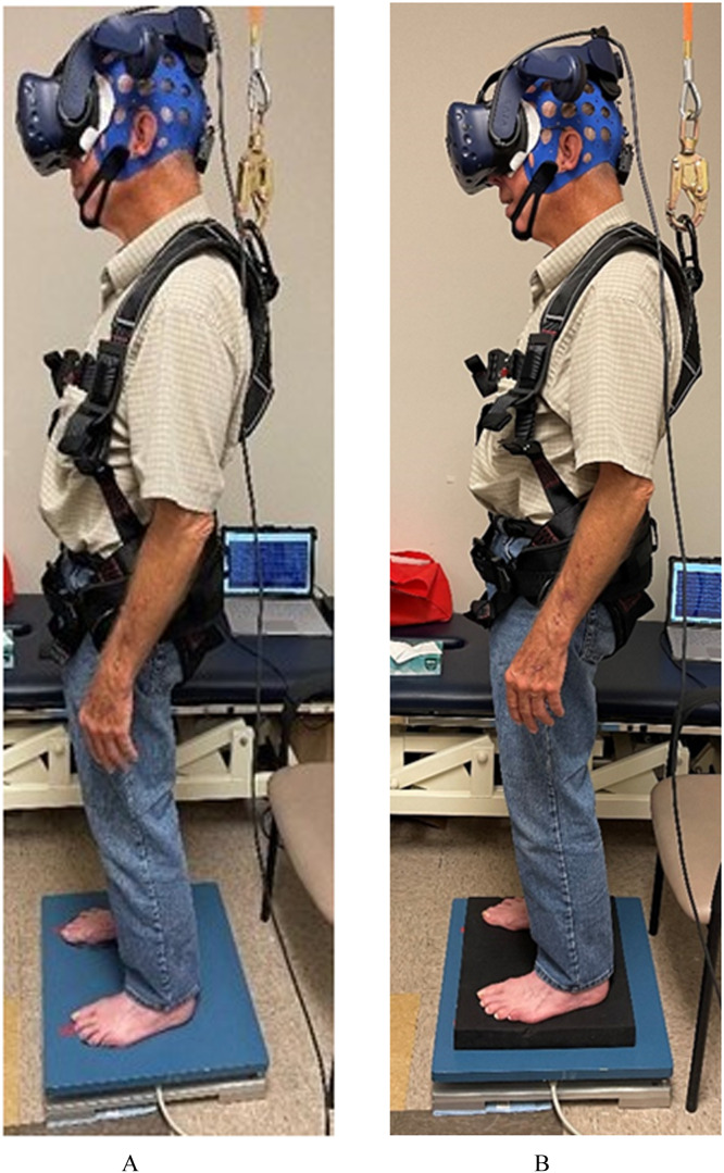 The Effect of Sensory Reweighting on Postural Control and Cortical Activity in Parkinson's Disease: A Pilot Study