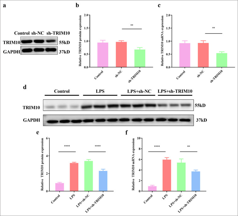 A mechanism study of tripartite motif 10 modulating septic cardiomyopathy.