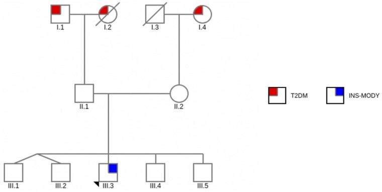 A Unique Phenotype of Maturity-Onset Diabetes of the Young With a Novel Disease-Causing Insulin Gene Variant.