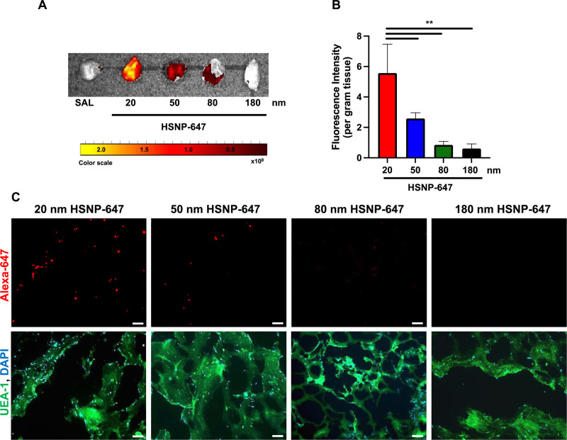Size-dependent Nanoparticle Accumulation In Venous Malformations.