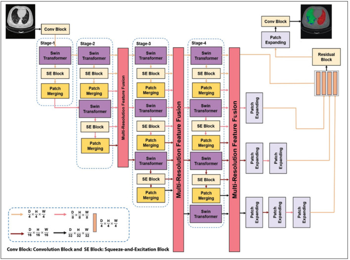 Identifying COVID-19-Infected Segments in Lung CT Scan Through Two Innovative Artificial Intelligence-Based Transformer Models.