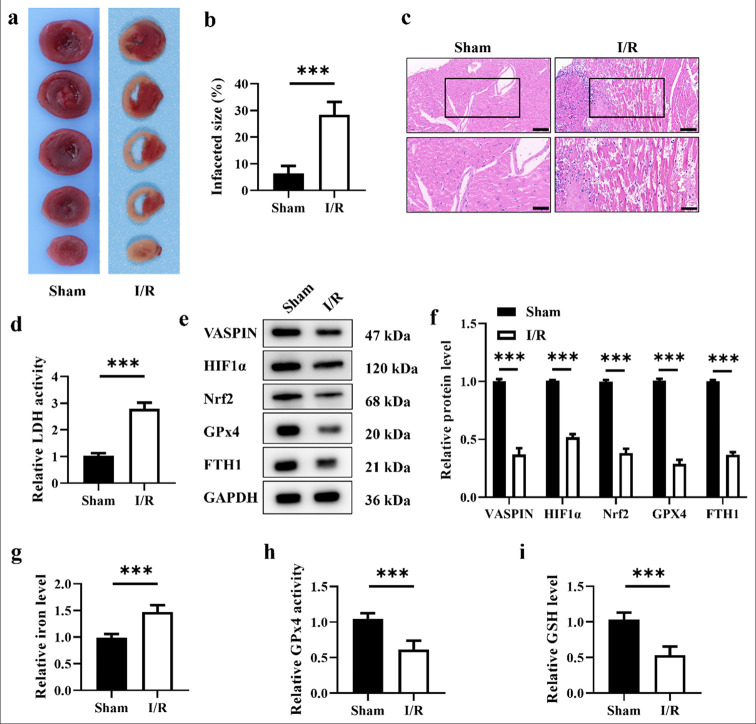 Vaspin inhibits ferroptosis: A new hope for treating myocardial ischemia-reperfusion injury.
