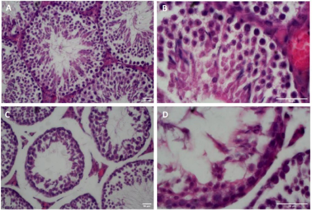 Secretome of human amniotic membrane stem cells promote recovery and testicular functions through modulating <i>SIRT1/NRF2/TNF-α</i> pathway in mice testicular torsion: An experimental study.