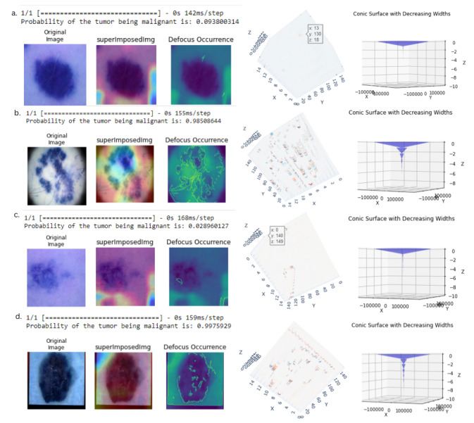 The Depth Estimation and Visualization of Dermatological Lesions: Development and Usability Study.