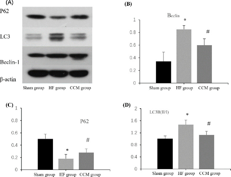 Effects of cardiac contractility modulation on autophagy and apoptosis of cardiac myocytes in rabbits with chronic heart failure.