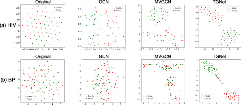 TGNet: tensor-based graph convolutional networks for multimodal brain network analysis.