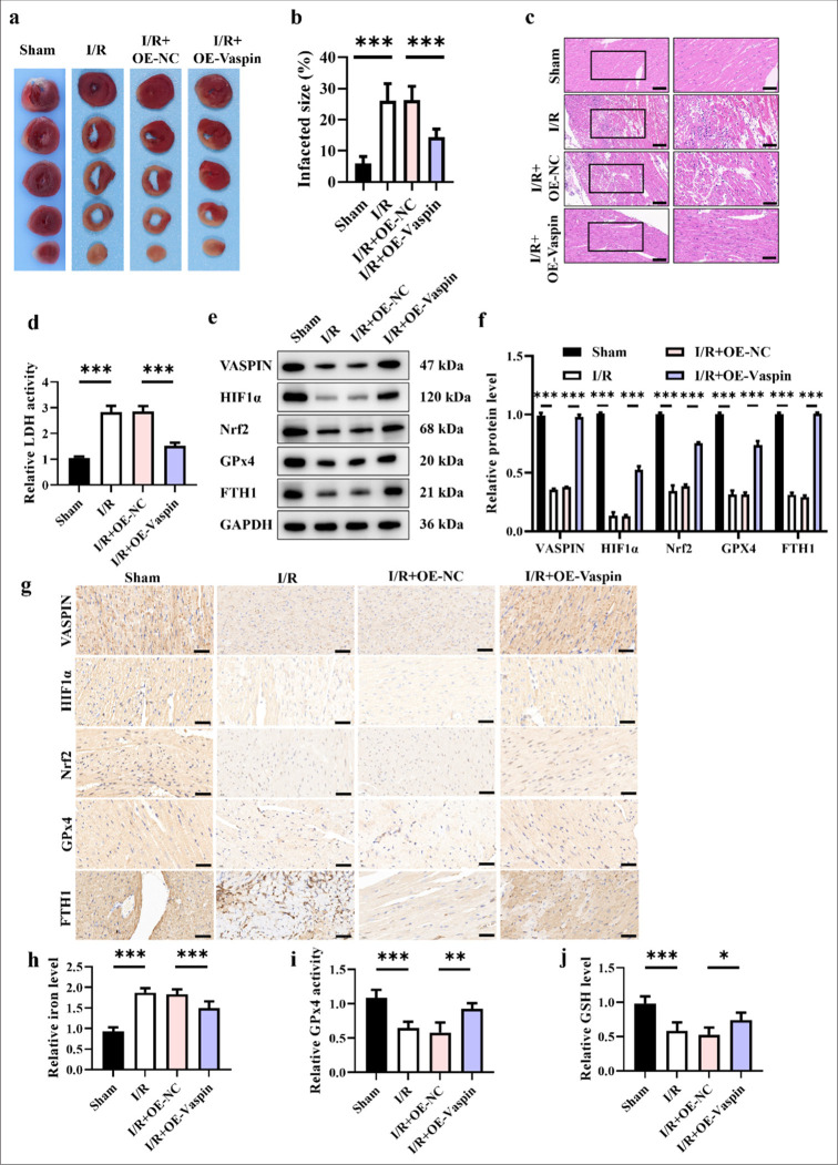 Vaspin inhibits ferroptosis: A new hope for treating myocardial ischemia-reperfusion injury.