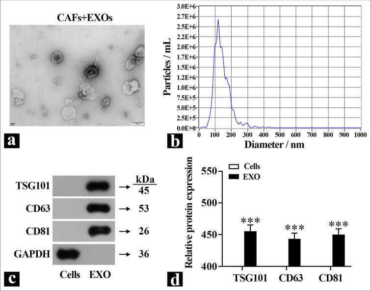 Exosomes derived from cancer-associated fibrolasts mediated ciplatin resistance.
