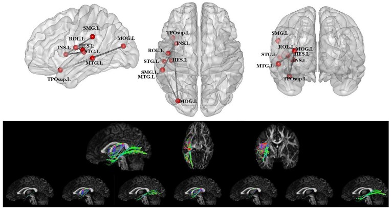 A decade of white matter connectivity studies in developmental dyslexia.