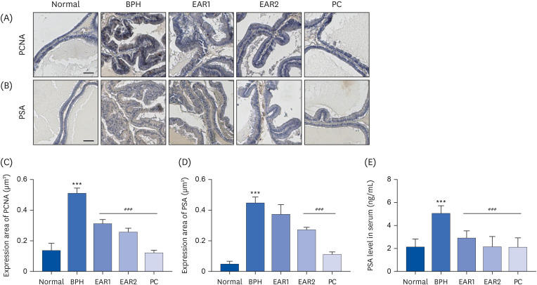 <i>Asparagi radix</i> alleviates testosterone-induced benign prostatic hyperplasia by inhibiting 5α-reductase activity and androgen receptor signaling pathway.