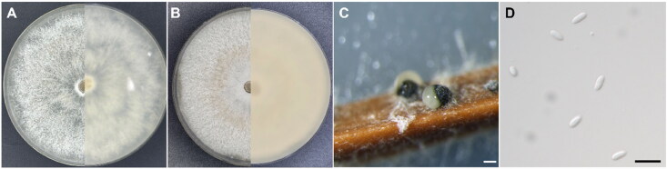 Four Unrecorded Species of Endophytic <i>Diaporthe</i> (Sordariomycetes) in Korea.