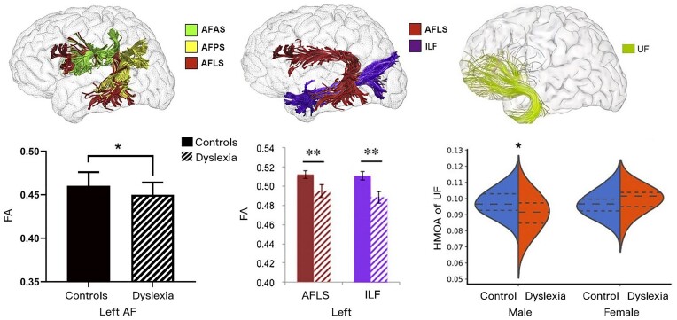 A decade of white matter connectivity studies in developmental dyslexia.