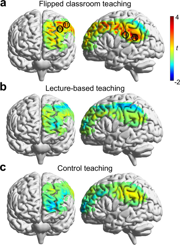Structured interaction between teacher and student in the flipped classroom enhances learning and interbrain synchrony.
