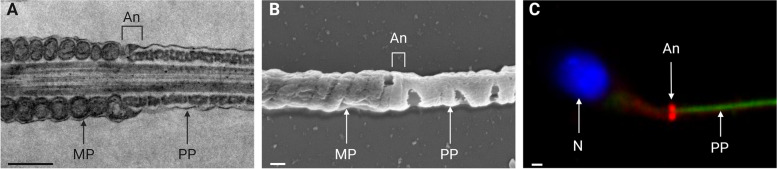The annulus: composition, role and importance in sperm flagellum biogenesis and male fertility.