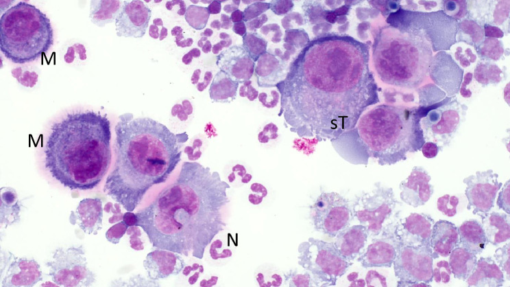 Adenocarcinoma and squamous cell carcinoma associated with gastric ulcers in alpacas.