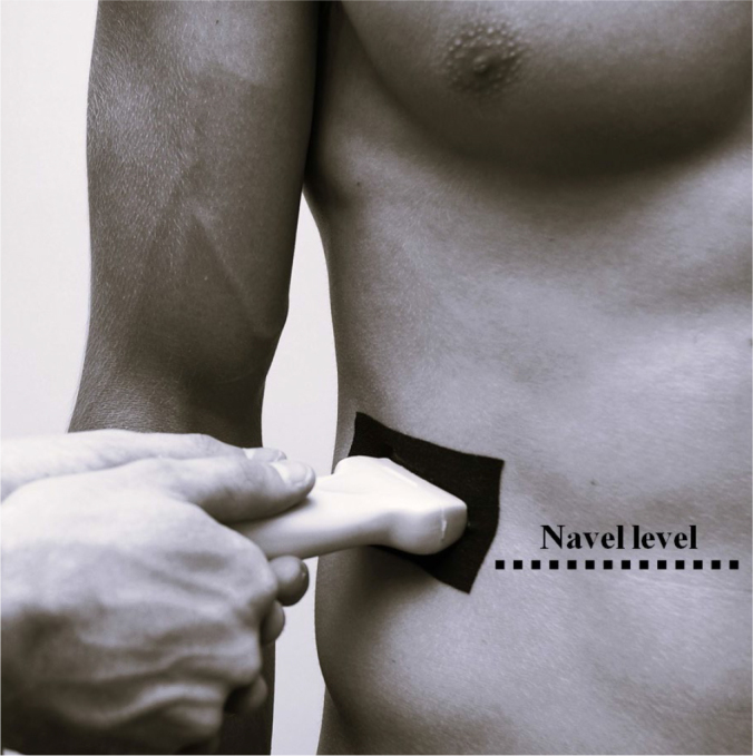 M-mode ultrasound evaluation of lateral abdominal muscle postural response to load: an exploratory study.