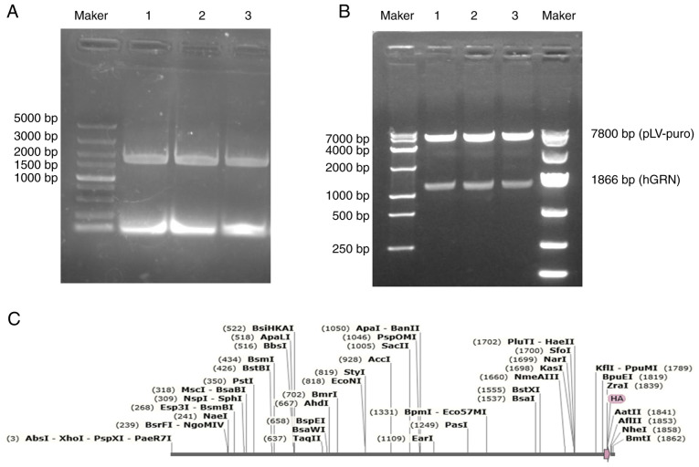 Effect of overexpression of <i>GRN</i> on the proliferation and osteogenic capacity of human periodontal cells.