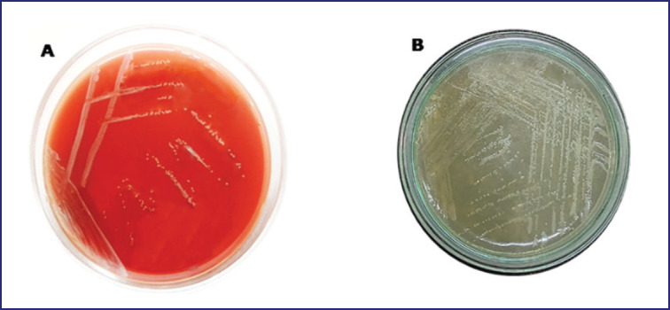 Immune response and protective efficacy of an experimentally developed inactivated oil adjuvant <i>Brucella abortus</i> vaccine in BALB/c mice.