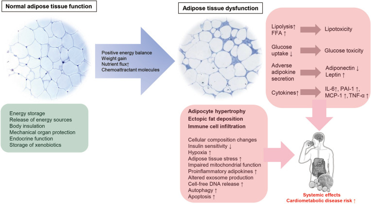 Understanding Adipose Tissue Dysfunction.