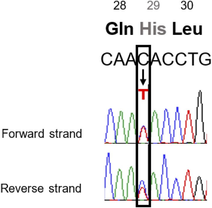 A Unique Phenotype of Maturity-Onset Diabetes of the Young With a Novel Disease-Causing Insulin Gene Variant.