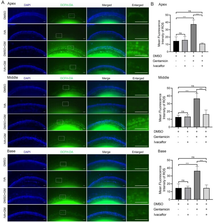 Ivacaftor attenuates gentamicin-induced ototoxicity through the CFTR-Nrf2-HO1/NQO1 pathway.
