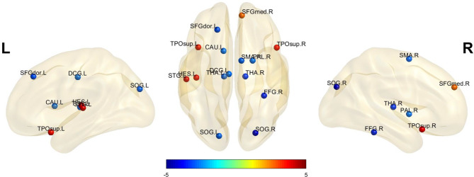 Altered neurovascular coupling and structure-function coupling in Moyamoya disease affect postoperative collateral formation.