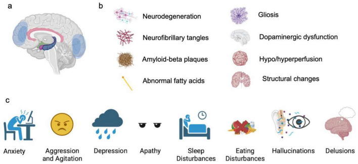 The neural basis of neuropsychiatric symptoms in Alzheimer's disease.
