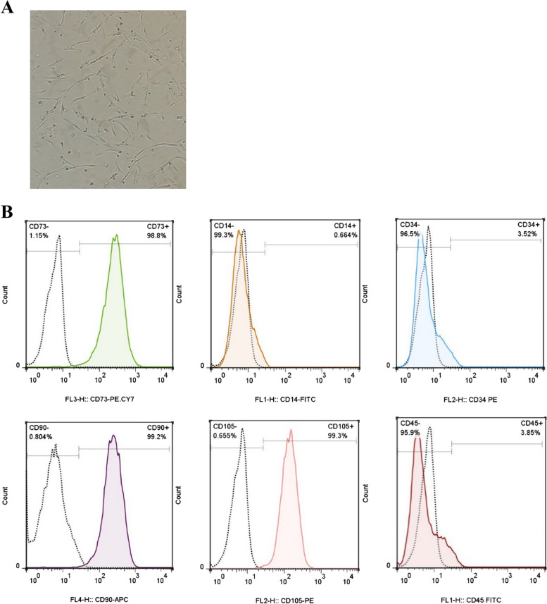 Bone marrow mesenchymal stem cell exosomes suppress JAK/STAT signaling pathway in acute myeloid leukemia in vitro.