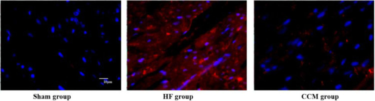 Effects of cardiac contractility modulation on autophagy and apoptosis of cardiac myocytes in rabbits with chronic heart failure.
