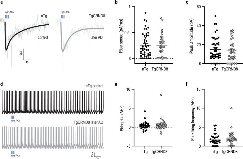 Enhanced prefrontal nicotinic signaling as evidence of active compensation in Alzheimer's disease models.