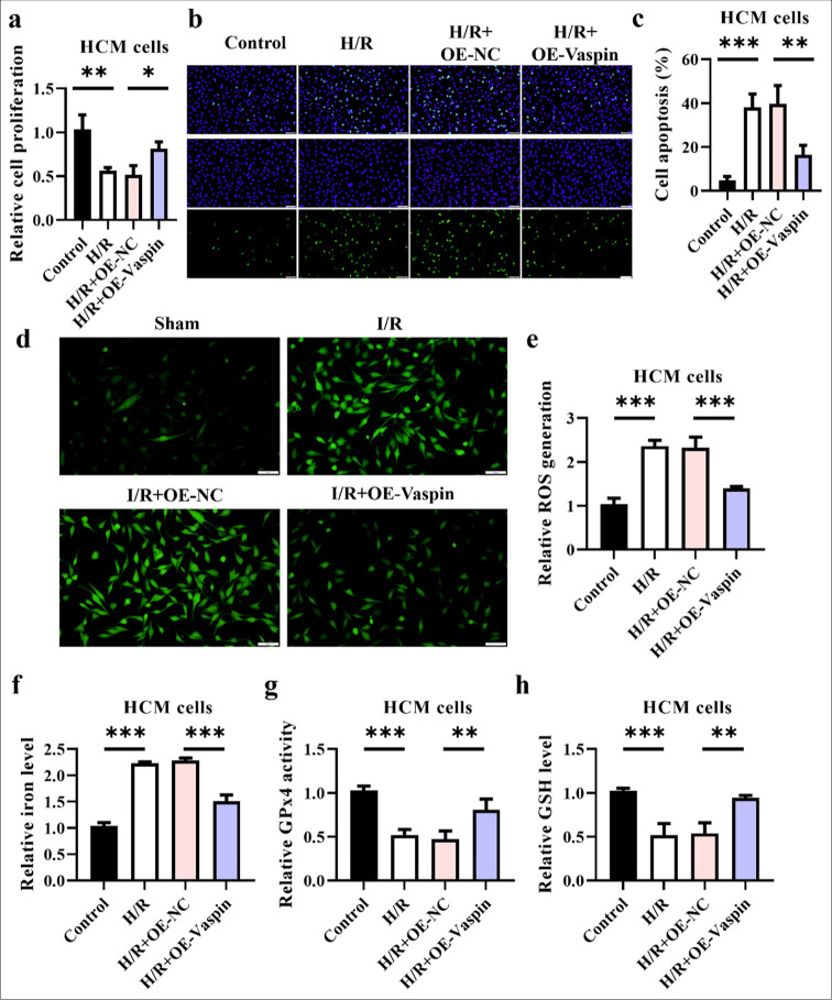 Vaspin inhibits ferroptosis: A new hope for treating myocardial ischemia-reperfusion injury.