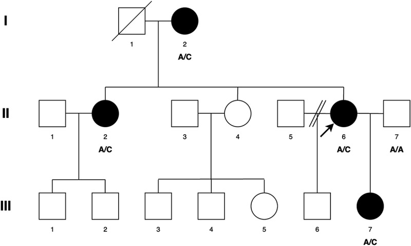 A novel frameshift variant in <i>BCOR</i> causes congenital nuclear cataract.