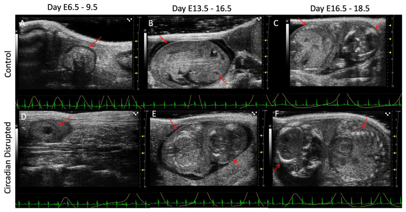 Circadian Disruption Impacts Fetal Development in Mice Using High-Frequency Ultrasound.