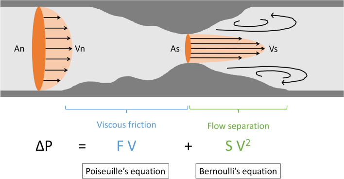 Intravascular ultrasound-derived virtual fractional flow reserve in the superficial femoral artery.