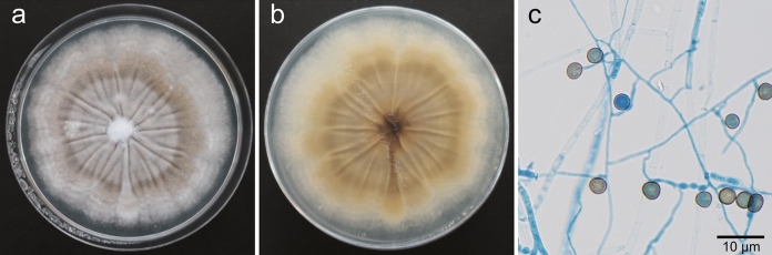 Fungal Keratitis Caused by Humicola sardiniae.