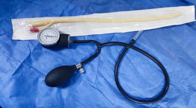 Effects of General Anesthesia on the Success Rate of Pneumatic Reduction in the Treatment of Intussusception.