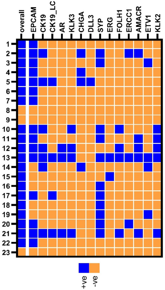 Multi-marker analysis of circulating tumor cells in localized intermediate/high-risk and metastatic prostate cancer.