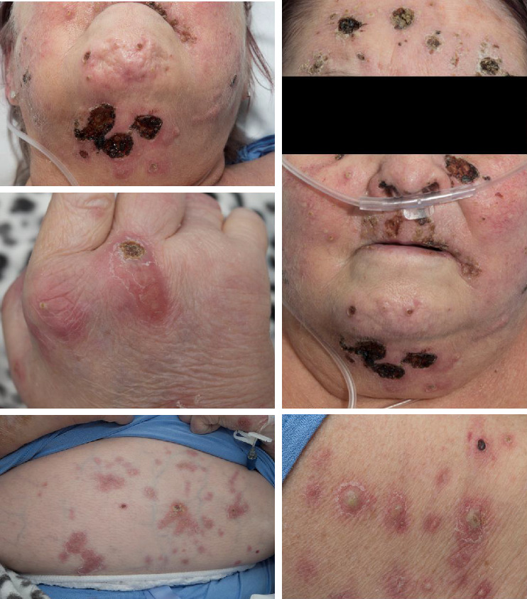 A Novel, Nonaquatic Zoonotic Transmission of <i>Mycobacterium marinum</i>.