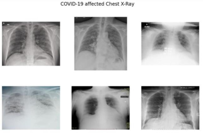 Leveraging compact convolutional transformers for enhanced COVID-19 detection in chest X-rays: a grad-CAM visualization approach.