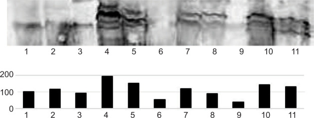 Relationship between ZHX2 Expression and VHL Gene Alteration in VHL-associated and Sporadic Hemangioblastomas of the Central Nervous System.
