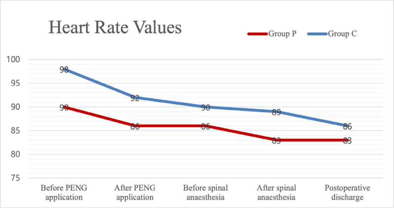 Efficacy of Preoperative Pericapsular Nerve Group Block in Patients with Hip Fracture and its Effect on the Success of Spinal Anaesthesia: A Retrospective Study.