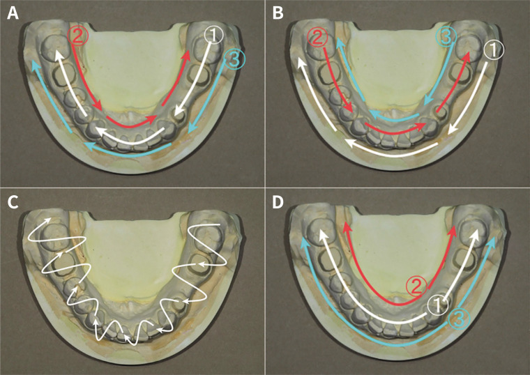 Effect of scan path on accuracy of complete arch intraoral scan.