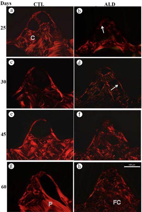 Effect of Long-Term Treatment with Alendronate on Bone Repair and Mineralization Around Implants in Rats.